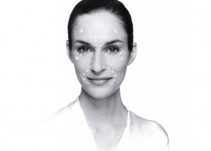 hyaluron-filler-modelo