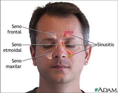 senos-paranasales